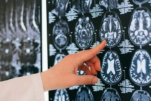 a medical professional analysing and pointing at scans