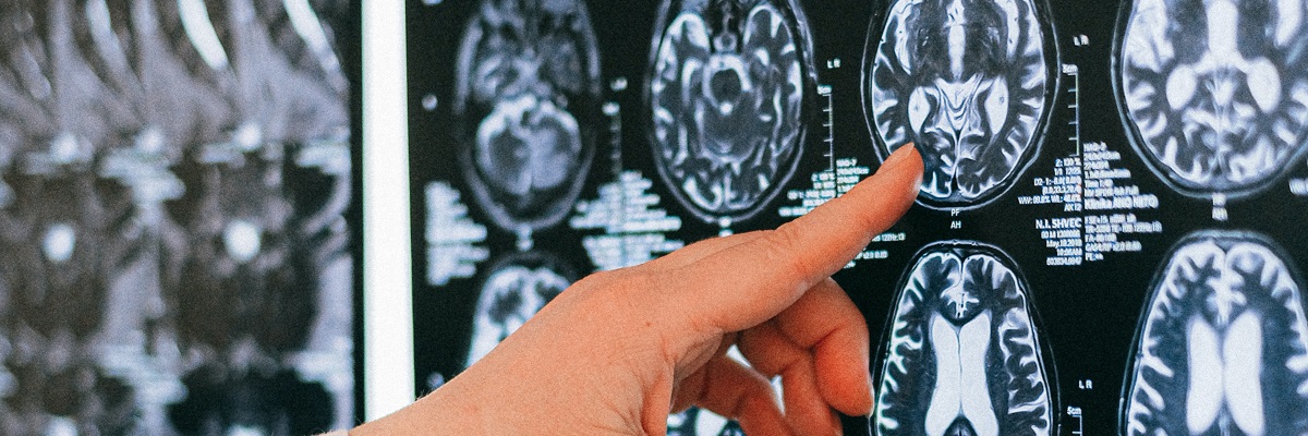 a medical professional analysing and pointing at scans